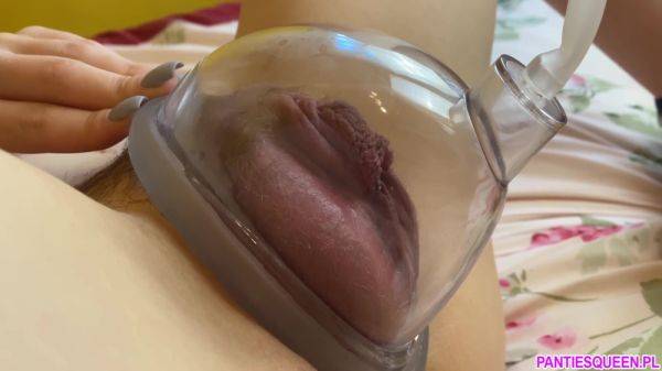 Play the hardcore clip called : Pumping Up My Vagina With A New Frohle Vacuum Pump 18 Min