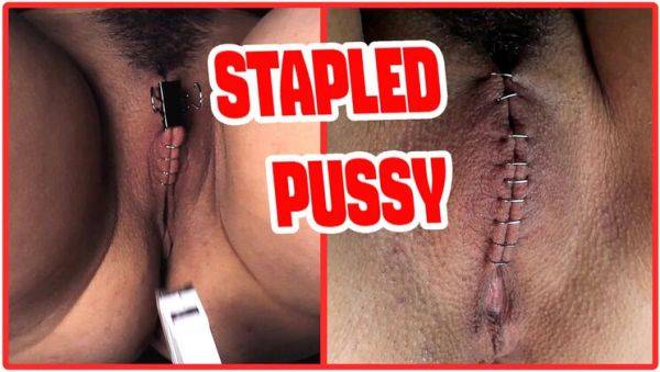 Play uncut clip called : Sadistic Doctor Staples Teen Goth Girl's Hairy Pussy in Extreme BDSM Medical Punishment