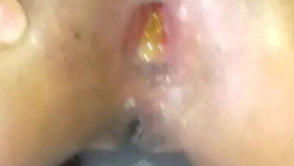 View this complete scene called : Daddy Stretches Teen's Big Ass Wide Open - Rough Anal Sex with Colombian Culona